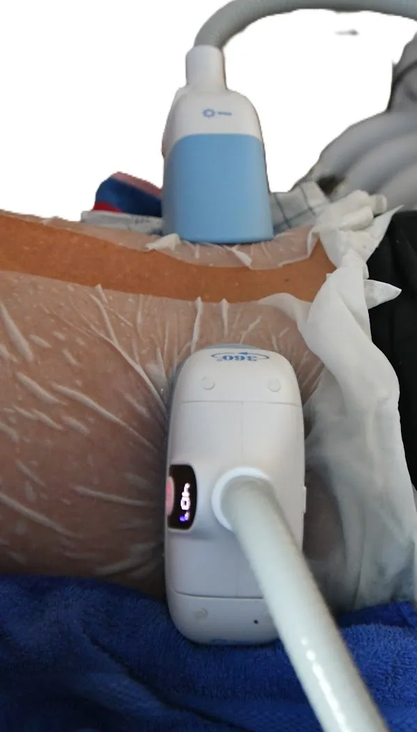 zellsius cryozone / Kältetherapie Heilbronn, Bild 2 von 3